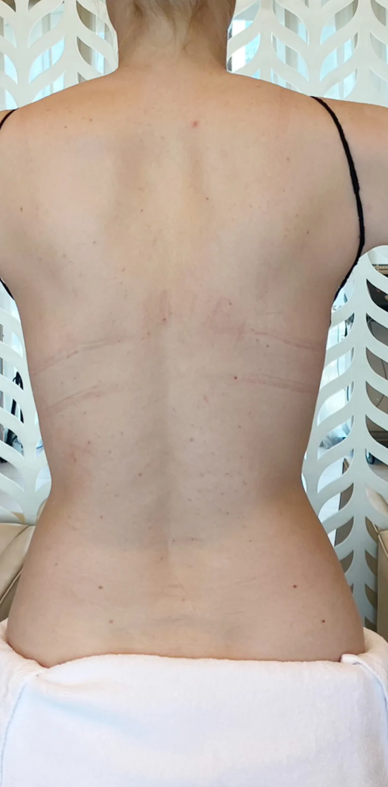 Before: Back sculpting